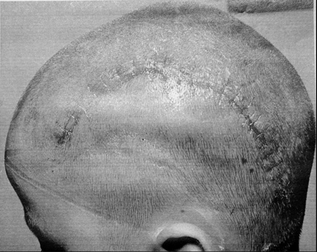 Miyamori victim_okinawa2